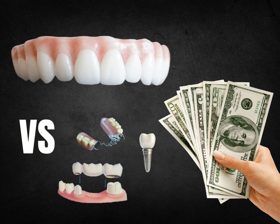 How Much Does Each Type of Dental Implant Cost?